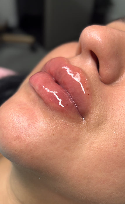 The Takeover ❤️‍🔥