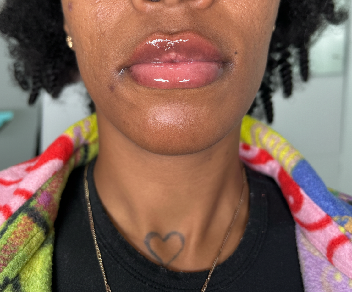The Signature Pout 💎